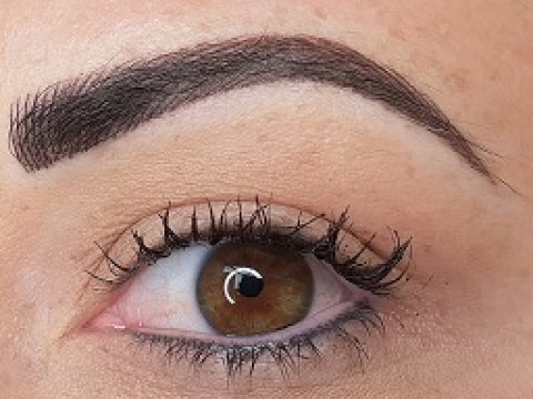3+ year healed liner